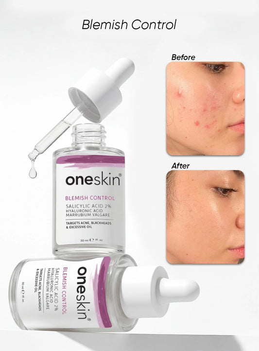 Blemish Control Salicylic Acid 2% + Marrubium Valgare - 30ml