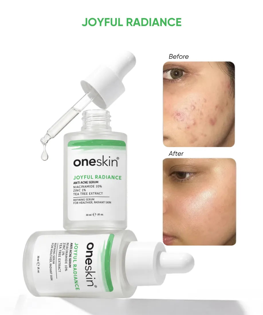 Joyful Radiance - Niacinamide 10%, Zinc 1%, Tea Tree Extract - 30ml