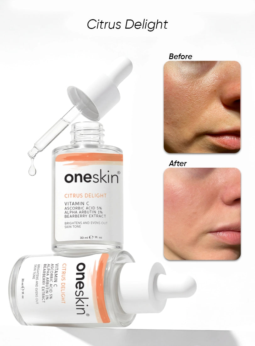 Citrus Delight - Vitamin C 5%, Alpha Arbutin 1%. Bearberry Extract - 30ml