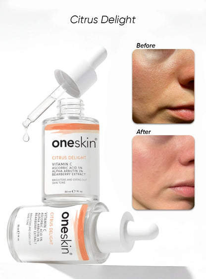 Citrus Delight - Vitamin C 5%, Alpha Arbutin 1%. Bearberry Extract - 30ml