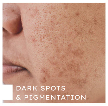 Shop By Concern Image