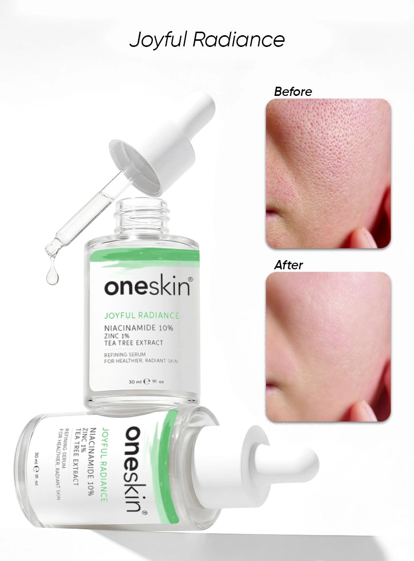 Joyful Radiance - Niacinamide 10%, Zinc 1%, Tea Tree Extract - 30ml