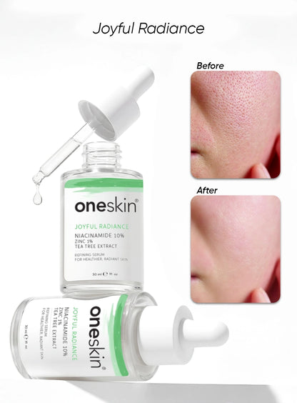 Joyful Radiance - Niacinamide 10%, Zinc 1%, Tea Tree Extract - 30ml